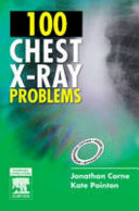 100 Chest X-ray Problems