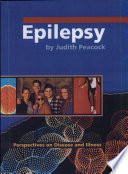 Epilepsy