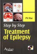 Step by Step Treatment of Epilepsy