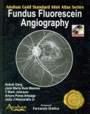 Fundus Fluorescein Angiography