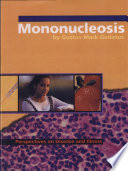 Mononucleosis