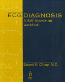 ECG Diagnosis