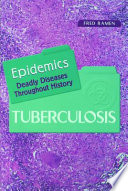 Tuberculosis