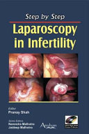 Laparoscopy