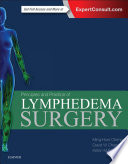 Principles and Practice of Lymphedema Surgery