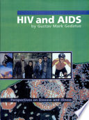 HIV and AIDS