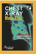 Chest X-ray Made Easy