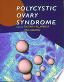 Polycystic Ovary Syndrome