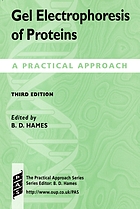 Gel electrophoresis of proteins