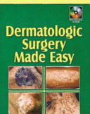 Dermatologic Surgery Made Easy