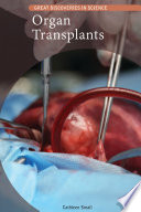 Organ Transplants