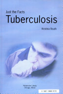 Tuberculosis