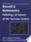 Russell & Rubinstein's Pathology of Tumors of the Nervous System 7Ed