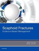 Scaphoid Fractures : evidence-based management