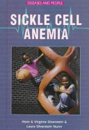 Sickle Cell Anemia